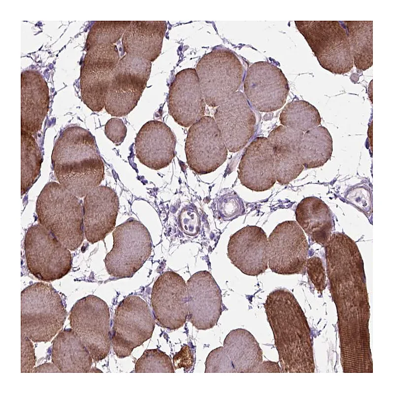 Atlas Antibodies Anti-MAPT Antibody