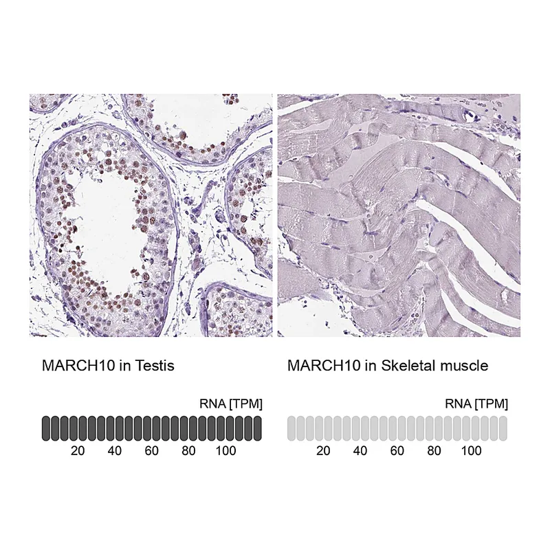 Atlas Antibodies Anti-MARCH10 Antibody