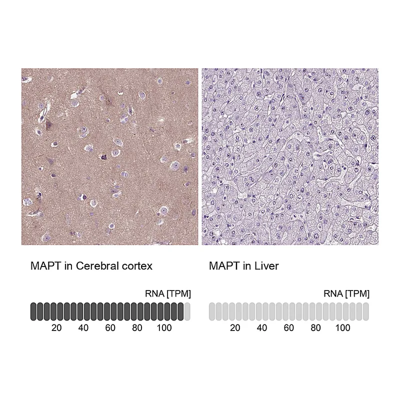 Atlas Antibodies Anti-MAPT Antibody
