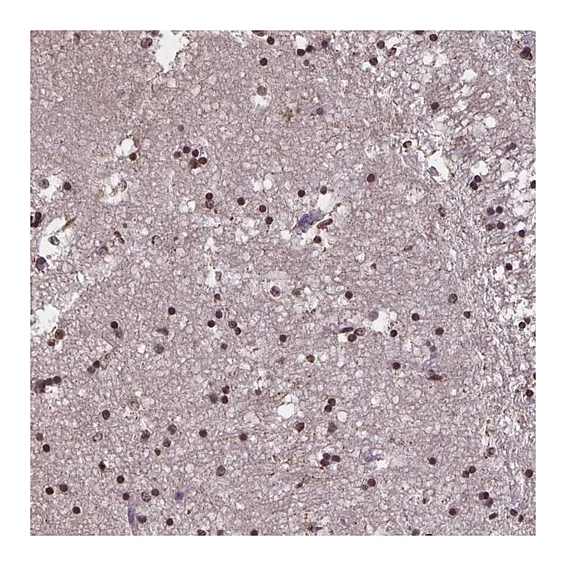 Atlas Antibodies Anti-MARCH6 Antibody
