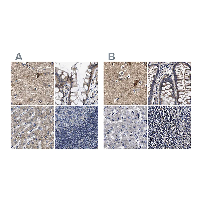 Atlas Antibodies Anti-MARCH7 Antibody
