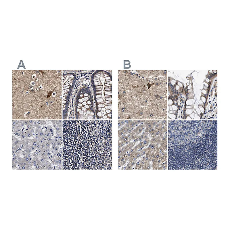 Atlas Antibodies Anti-MARCH7 Antibody