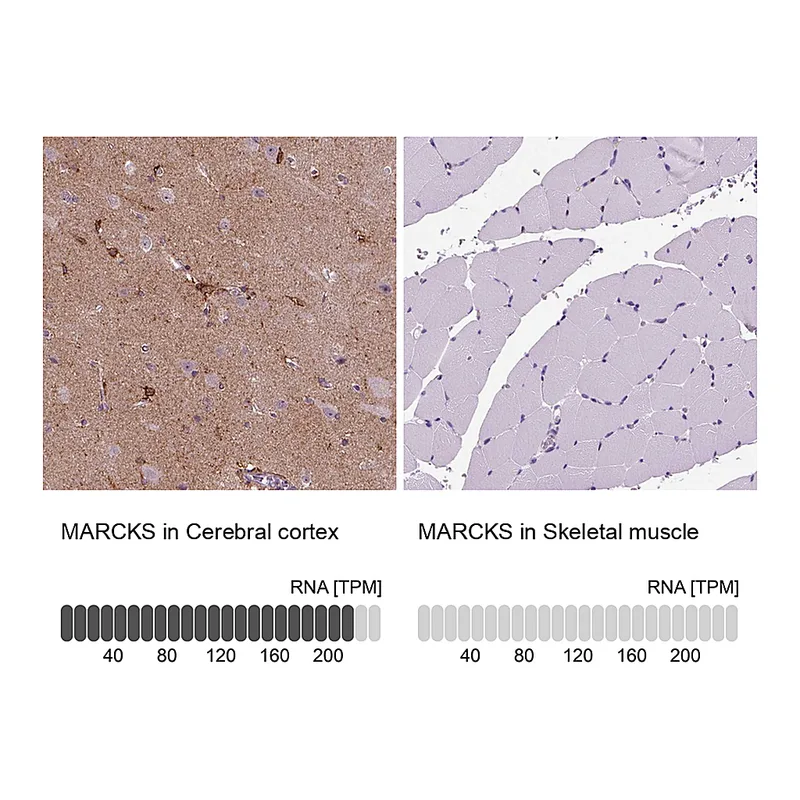 Atlas Antibodies Anti-MARCKS Antibody