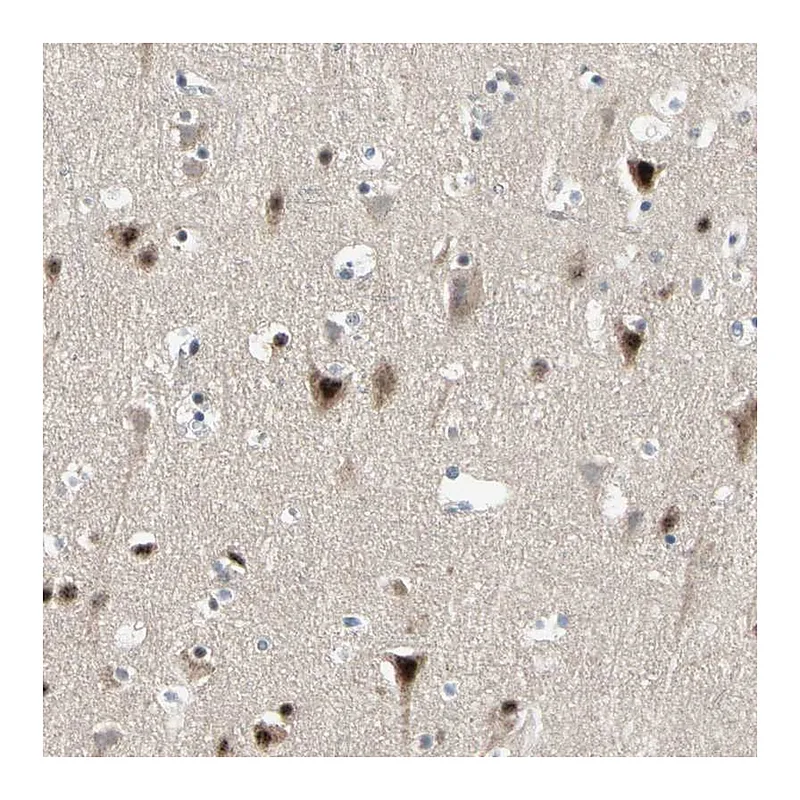 Atlas Antibodies Anti-MARK1 Antibody