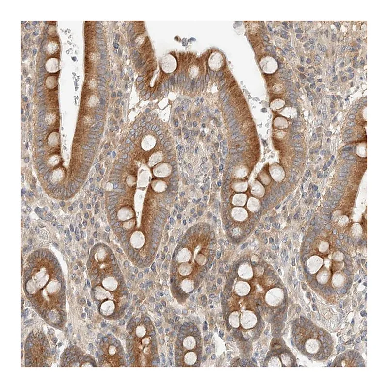 Atlas Antibodies Anti-MARK3 Antibody