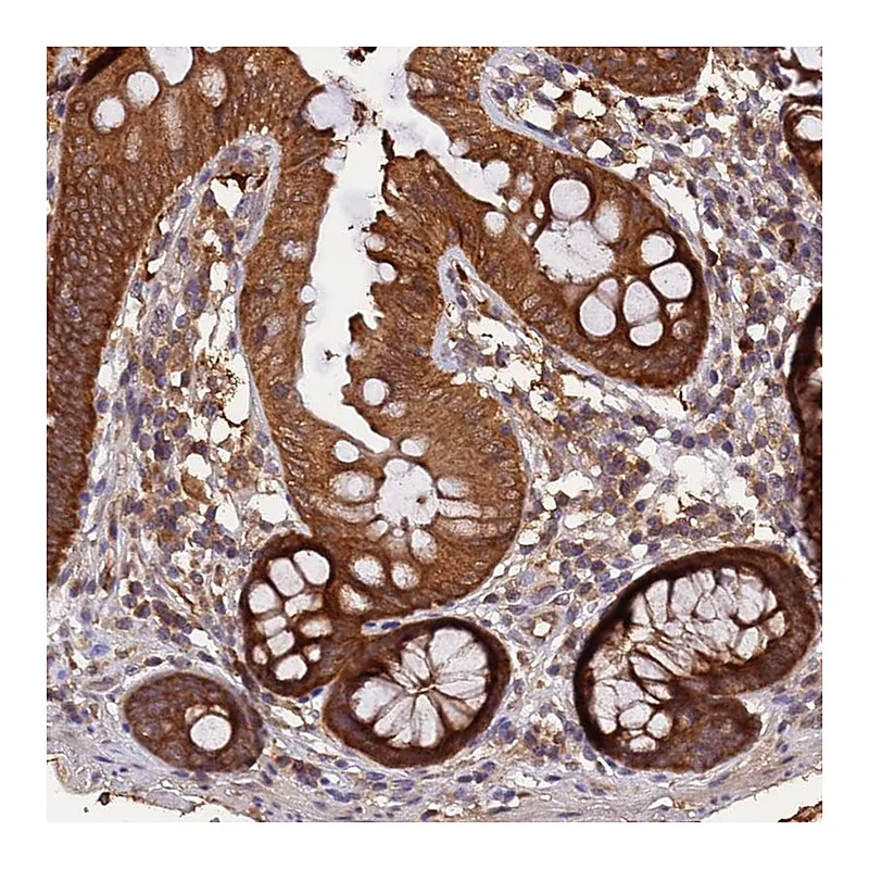 Atlas Antibodies Anti-MARK4 Antibody