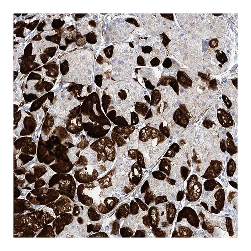 Atlas Antibodies Anti-MARS2 Antibody
