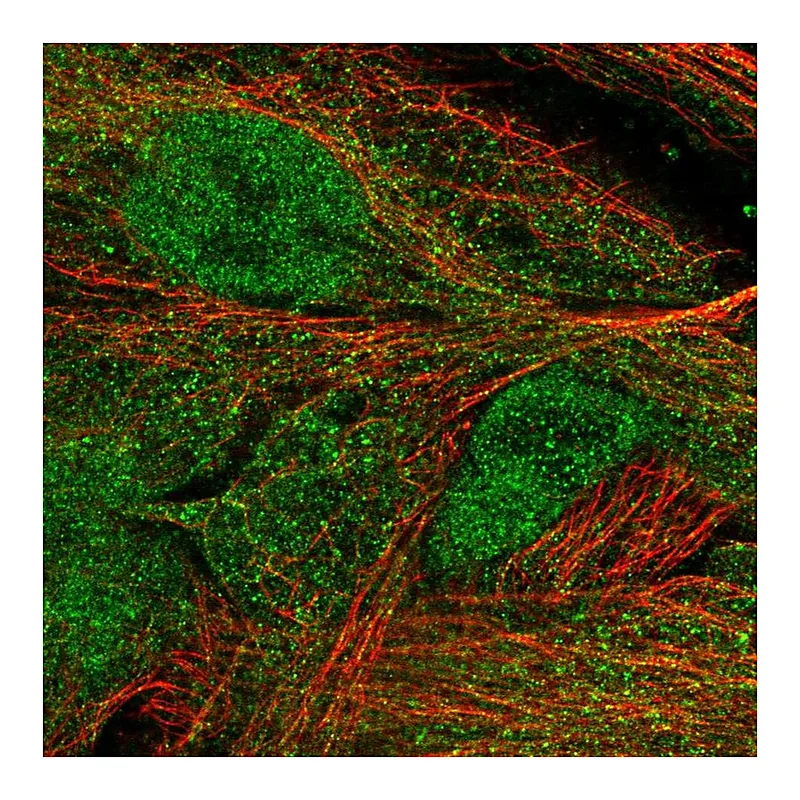 Atlas Antibodies Anti-MASP1 Antibody