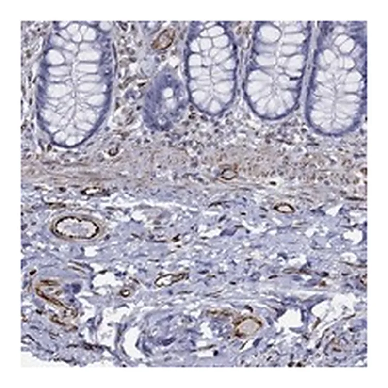 Atlas Antibodies Anti-MAS1 Antibody