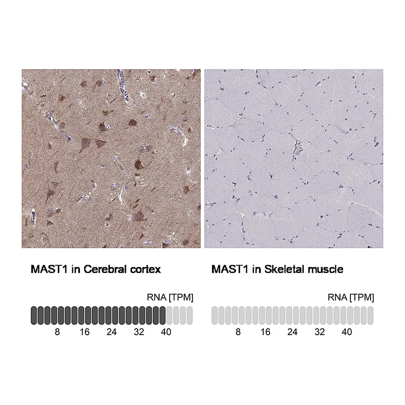 Atlas Antibodies Anti-MAST1 Antibody