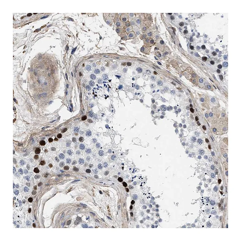 Atlas Antibodies Anti-MAS1L Antibody