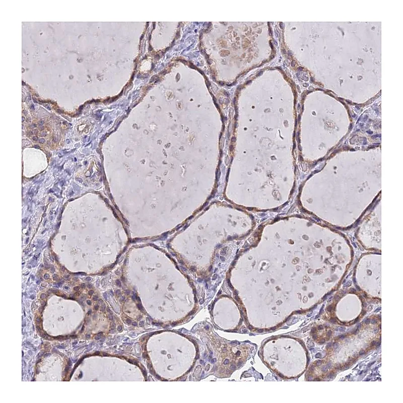 Atlas Antibodies Anti-MARVELD2 Antibody