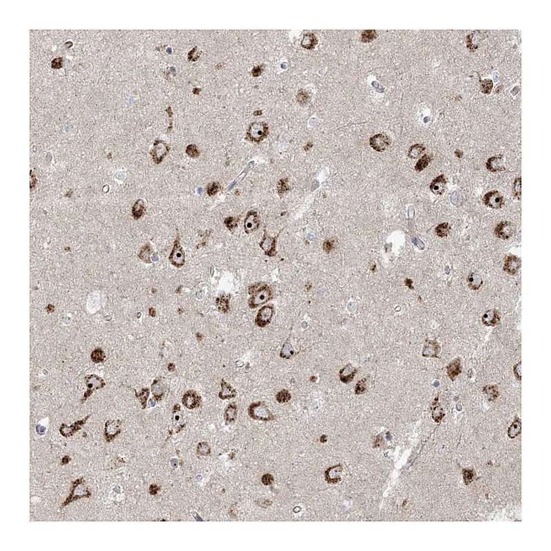 Atlas Antibodies Anti-MARS2 Antibody