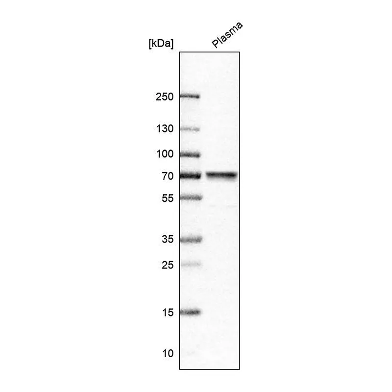 Atlas Antibodies Anti-MASP2 Antibody
