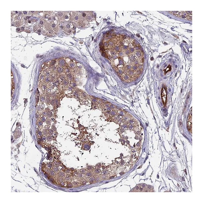 Atlas Antibodies Anti-MAST2 Antibody