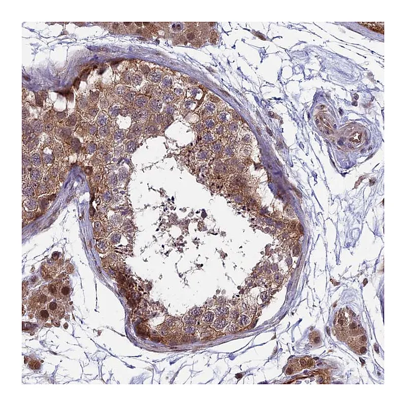 Atlas Antibodies Anti-MAST2 Antibody