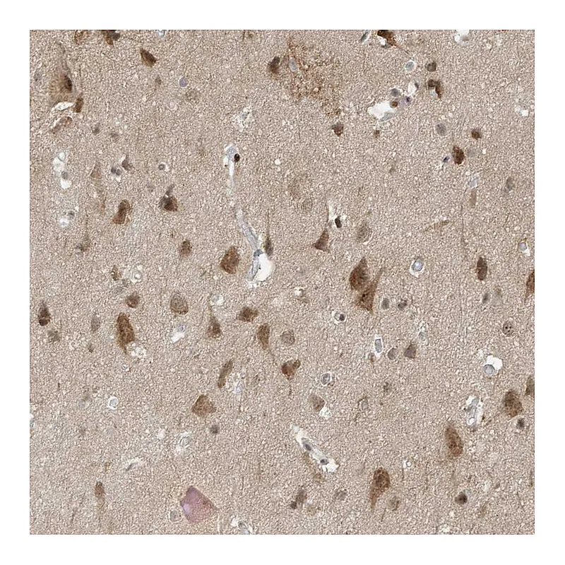 Atlas Antibodies Anti-MAST3 Antibody