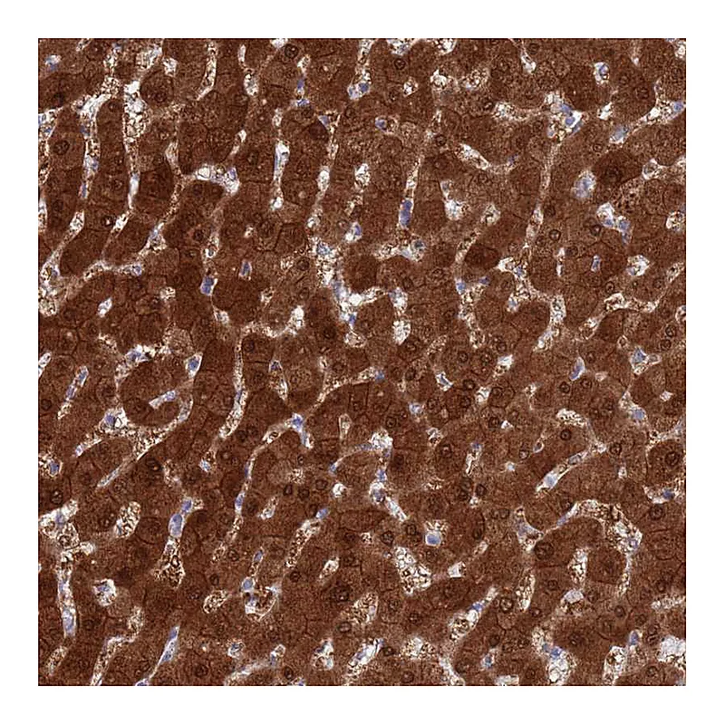 Atlas Antibodies Anti-MAT1A Antibody