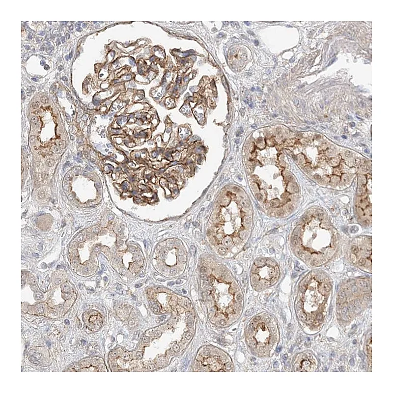 Atlas Antibodies Anti-MAT2B Antibody
