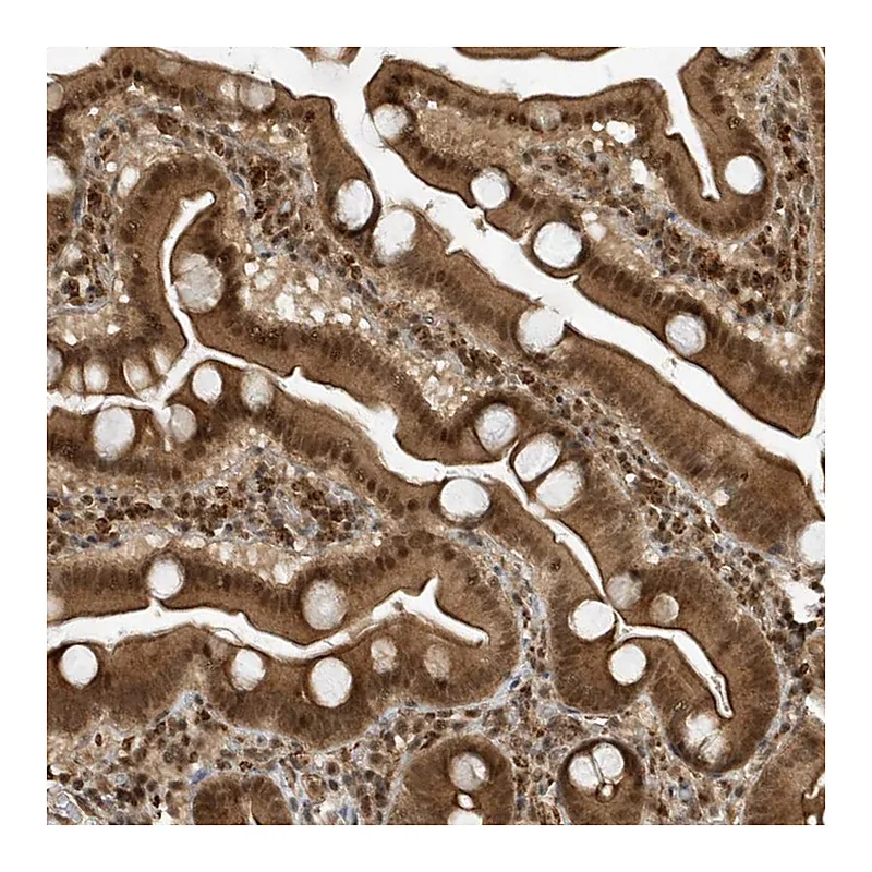 Atlas Antibodies Anti-MAST3 Antibody