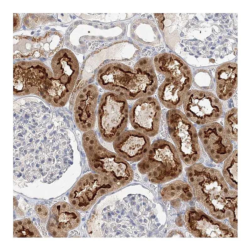 Atlas Antibodies Anti-MAT2B Antibody