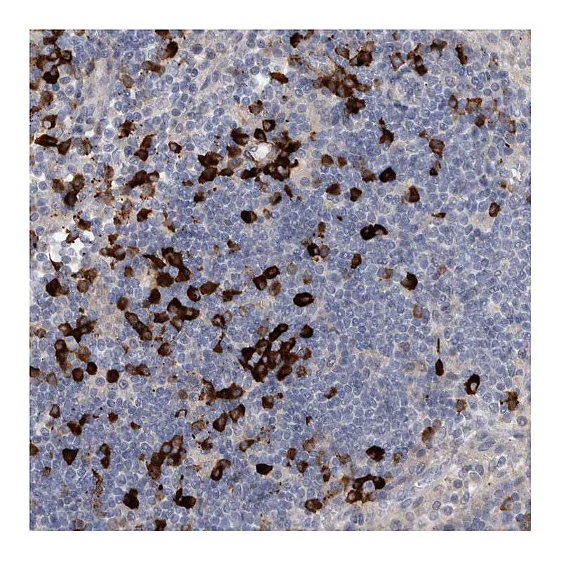 Atlas Antibodies Anti-MASTL Antibody