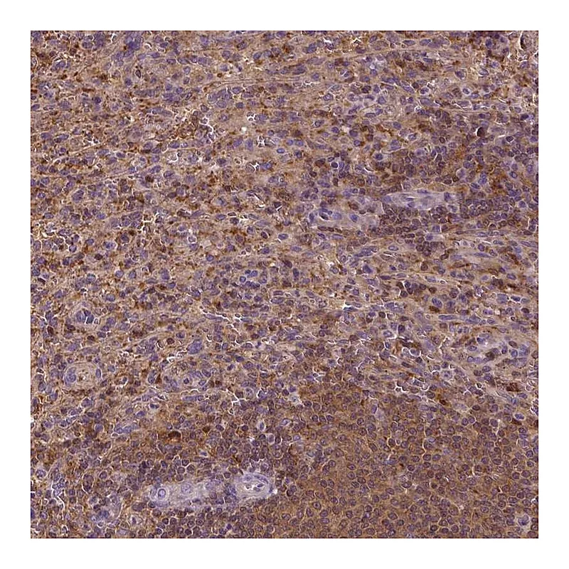 Atlas Antibodies Anti-MATK Antibody
