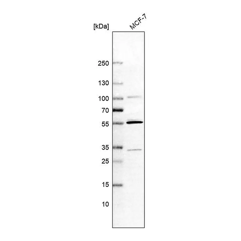Atlas Antibodies Anti-MATK Antibody