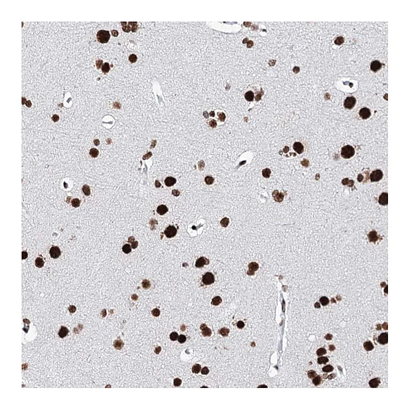 Atlas Antibodies Anti-MATR3 Antibody