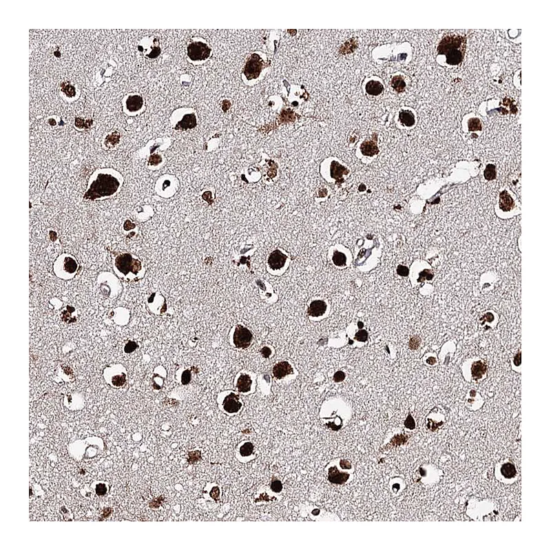 Atlas Antibodies Anti-MATR3 Antibody