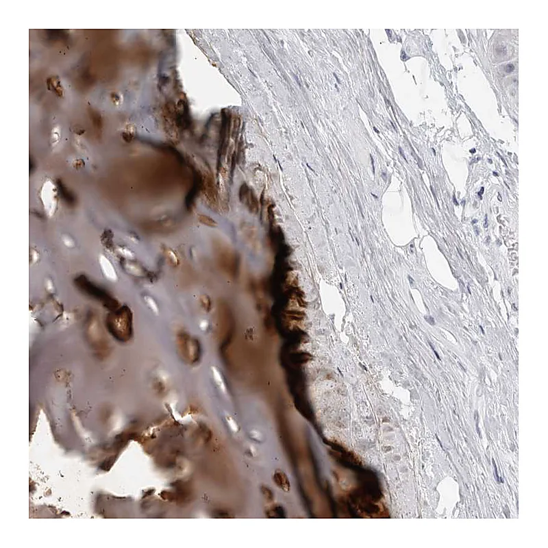 Atlas Antibodies Anti-MATN1 Antibody