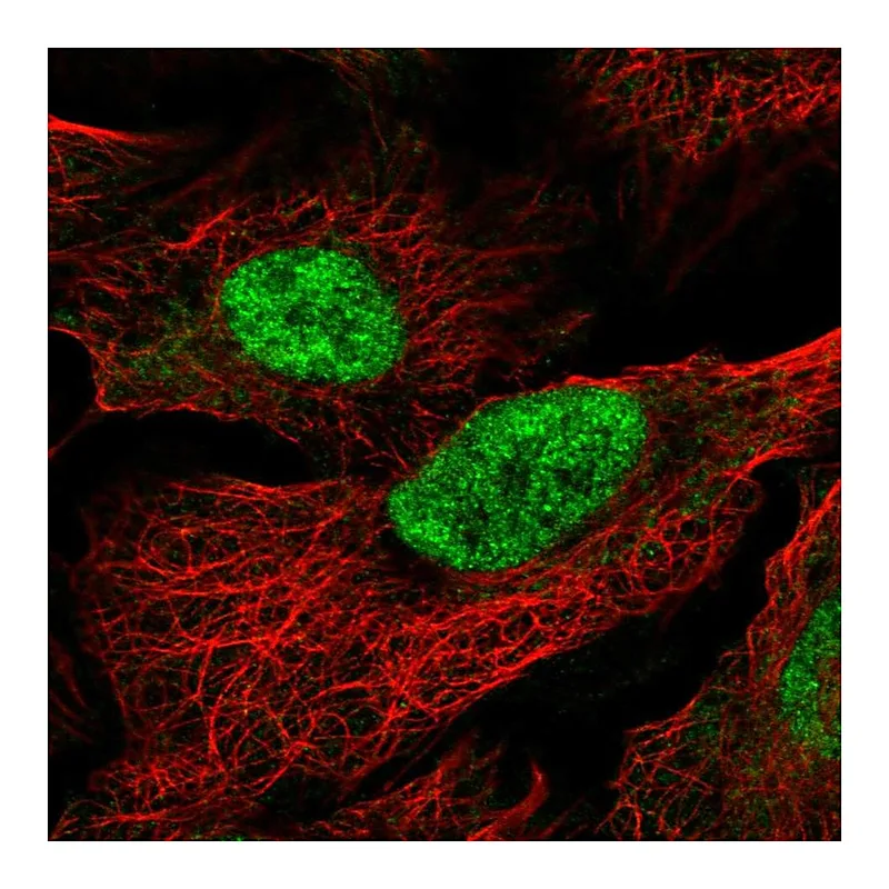 Atlas Antibodies Anti-MAU2 Antibody