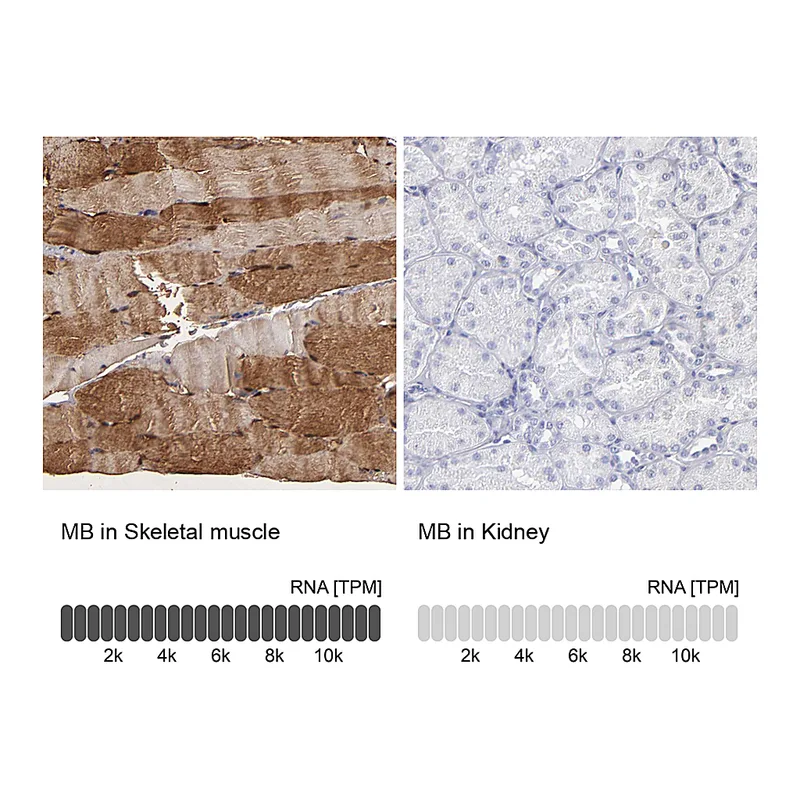 Atlas Antibodies Anti-MB Antibody