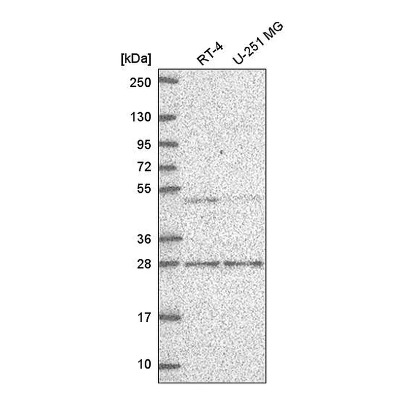 Atlas Antibodies Anti-MBD2 Antibody
