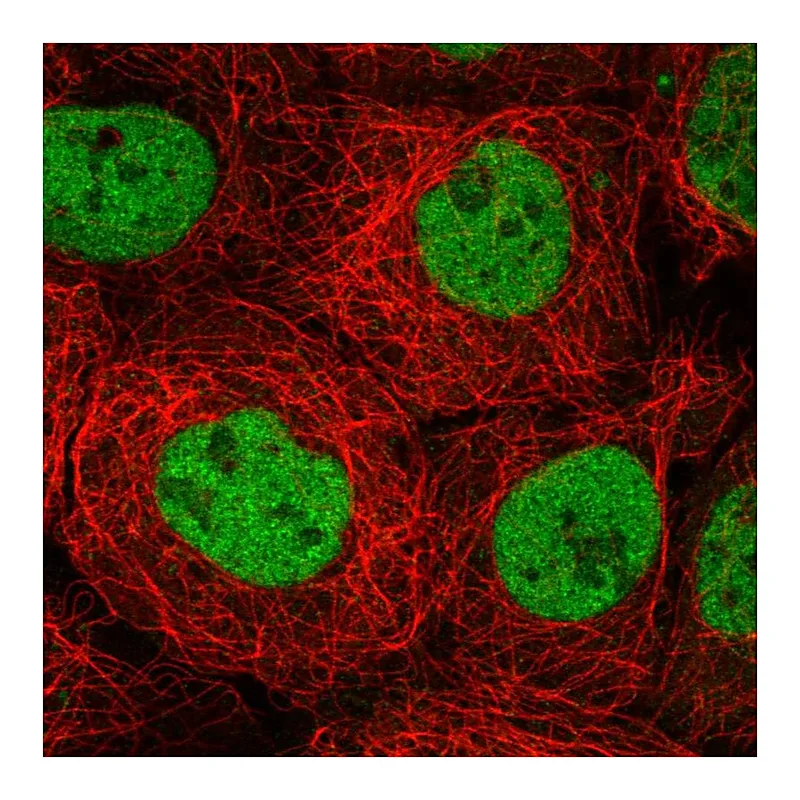 Atlas Antibodies Anti-MBD2 Antibody