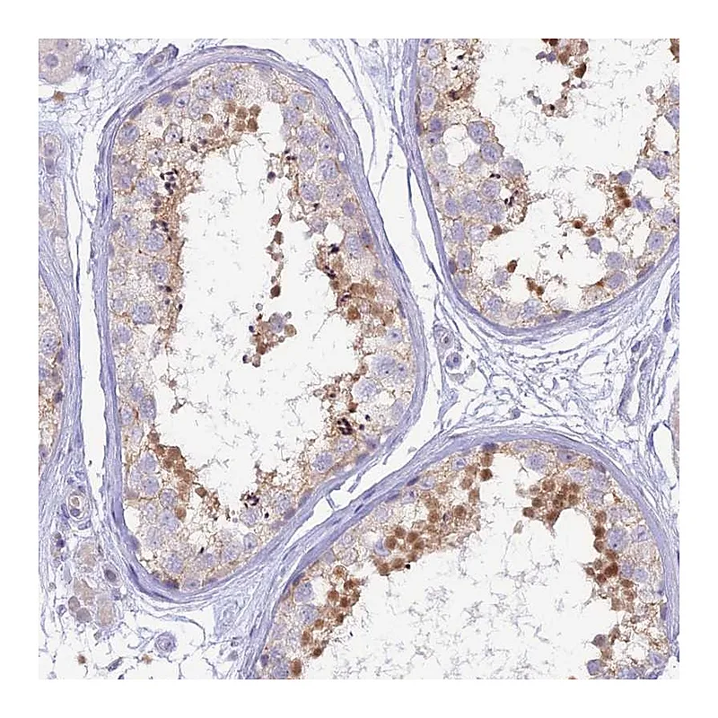 Atlas Antibodies Anti-MBD3L1 Antibody