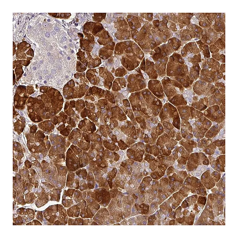 Atlas Antibodies Anti-MBD3L3 Antibody