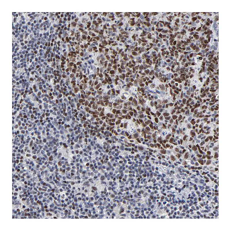 Atlas Antibodies Anti-MBD4 Antibody