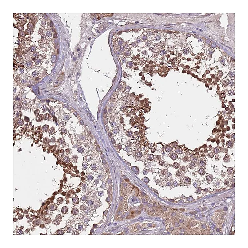 Atlas Antibodies Anti-MBD3L1 Antibody