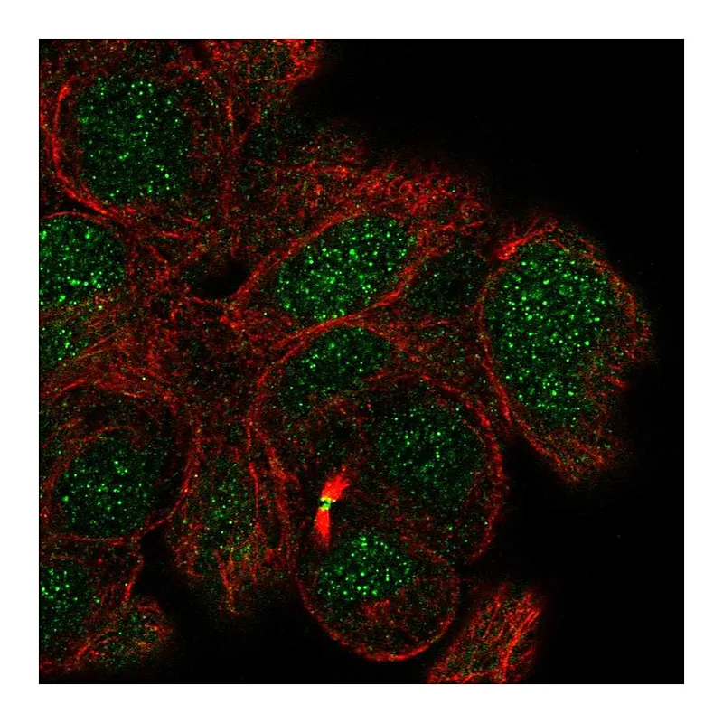 Atlas Antibodies Anti-MBD5 Antibody