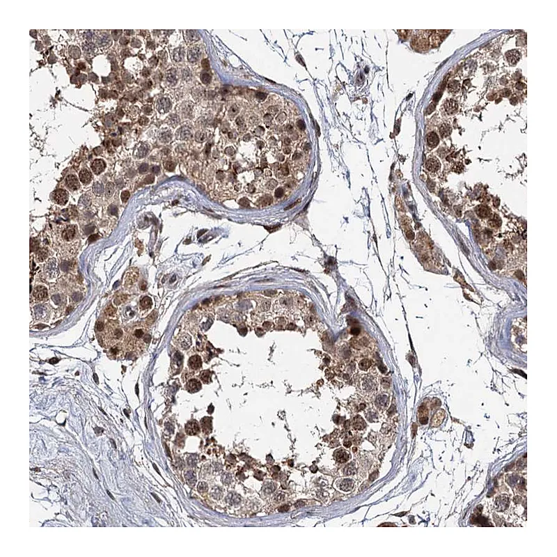 Atlas Antibodies Anti-MBD6 Antibody