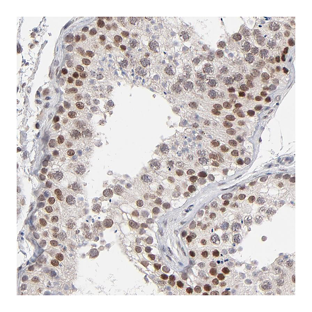 Atlas Antibodies Anti-MBIP Antibody