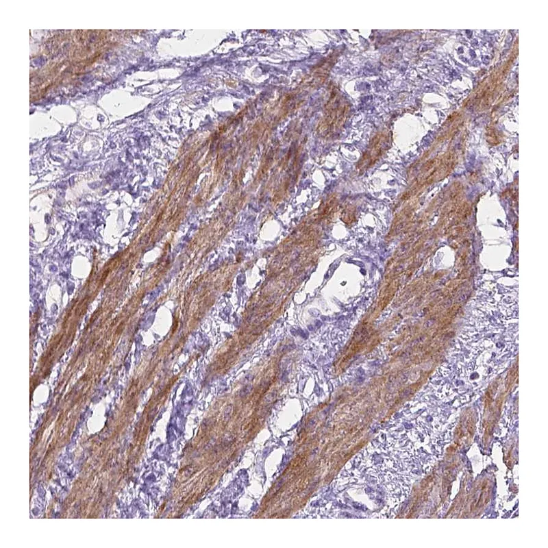 Atlas Antibodies Anti-MBLAC1 Antibody