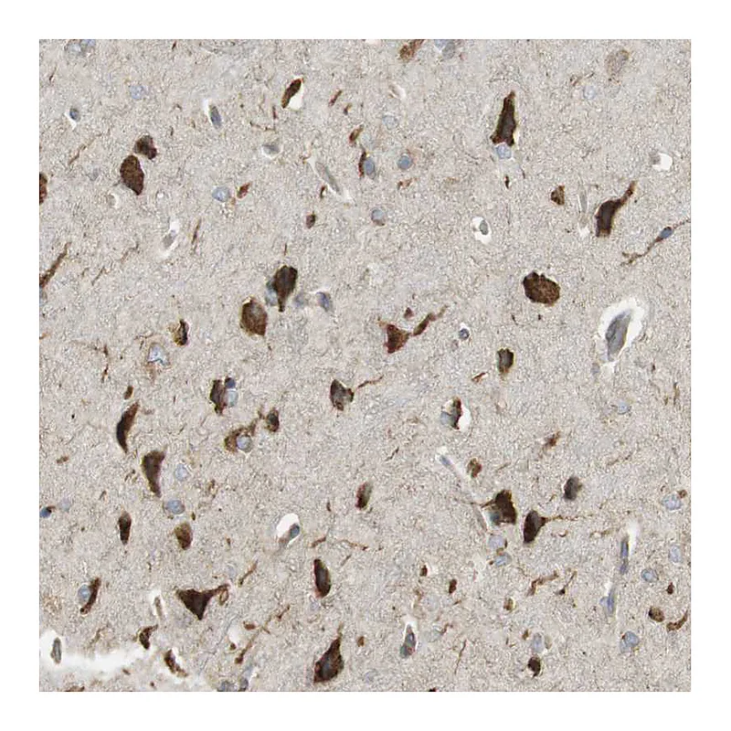 Atlas Antibodies Anti-MBOAT2 Antibody