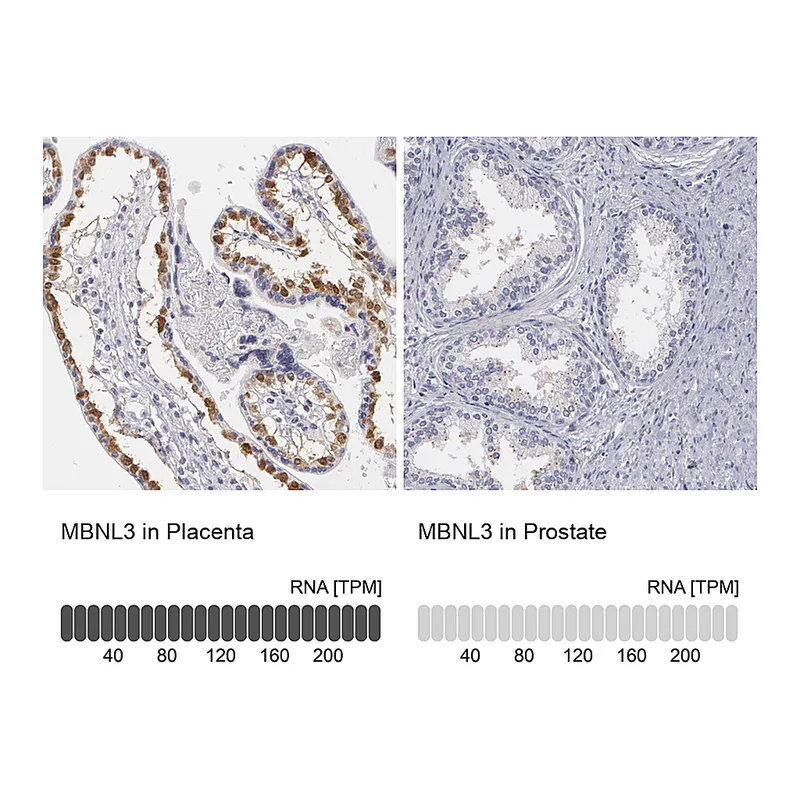 Atlas Antibodies Anti-MBNL3 Antibody