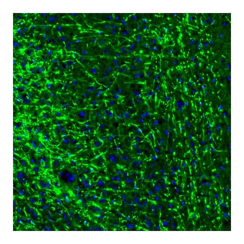 Atlas Antibodies Anti-MBP Antibody