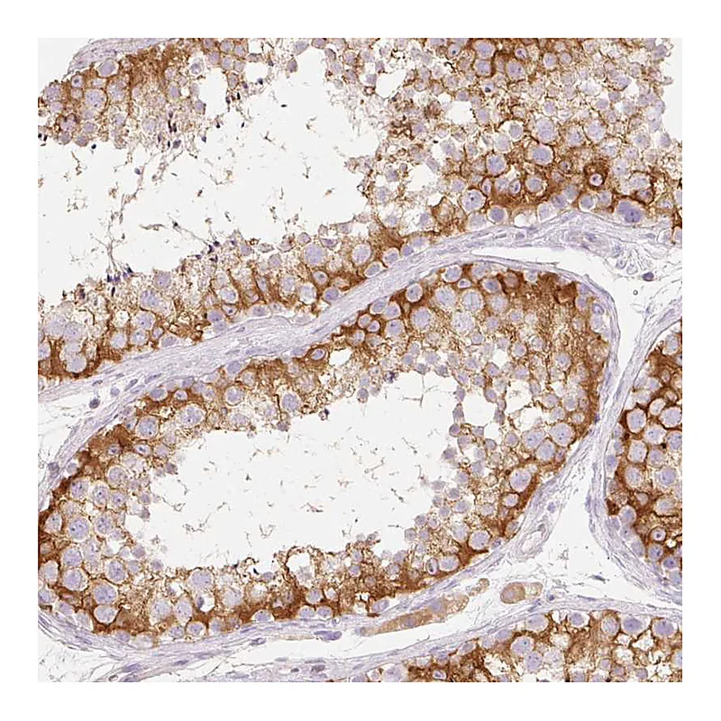 Atlas Antibodies Anti-MBOAT7 Antibody