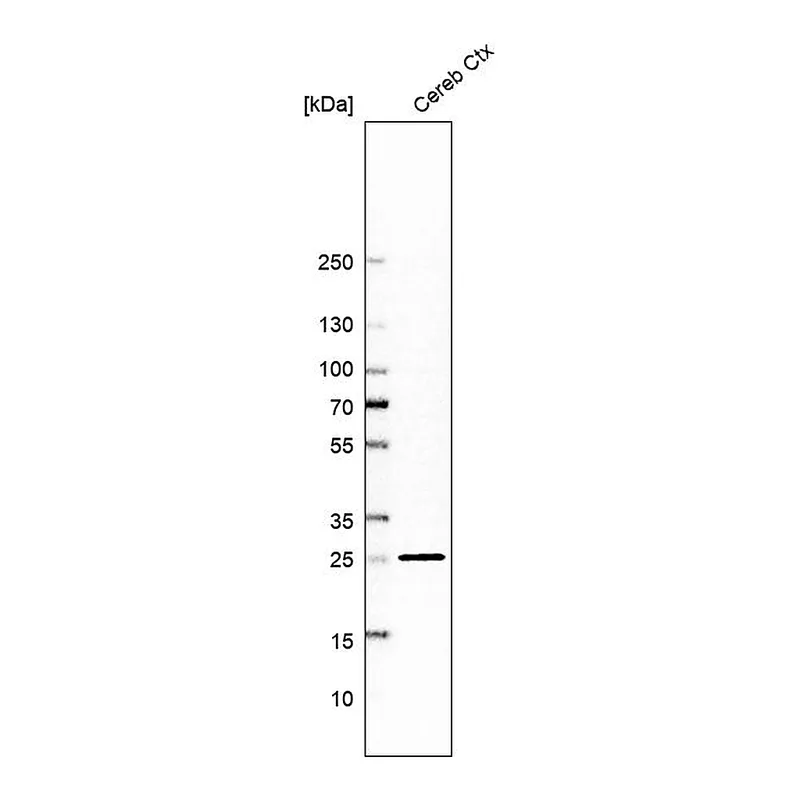 Atlas Antibodies Anti-MBP Antibody