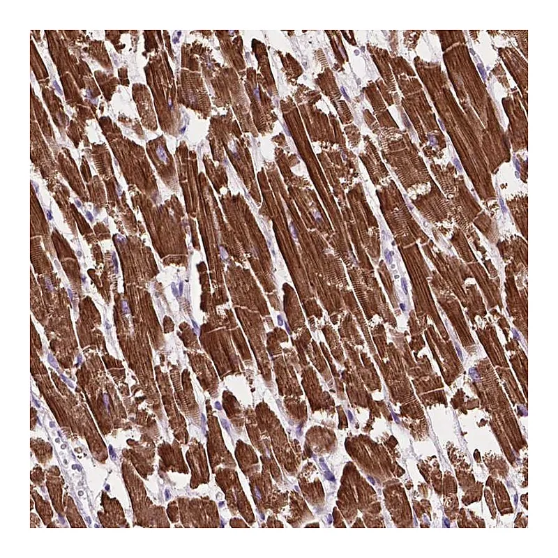 Atlas Antibodies Anti-MBTPS1 Antibody