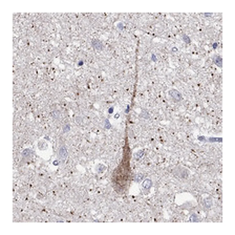 Atlas Antibodies Anti-MC3R Antibody